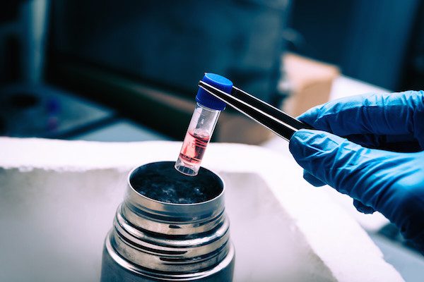 stem cells regenerative therapy