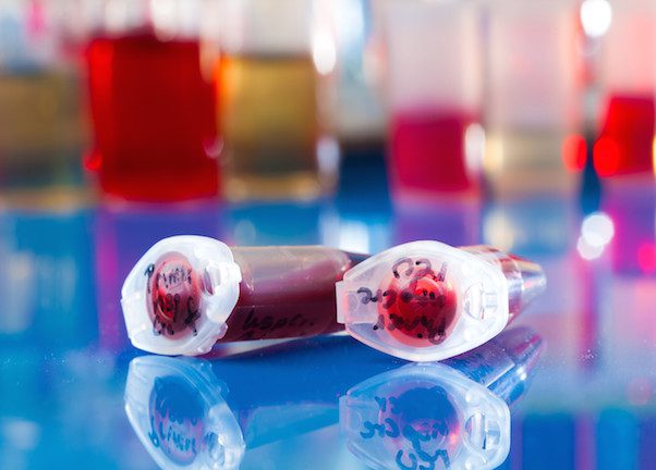 stem cell viles