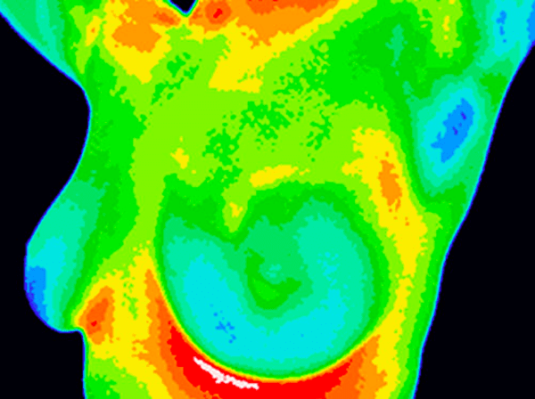 breast thermography