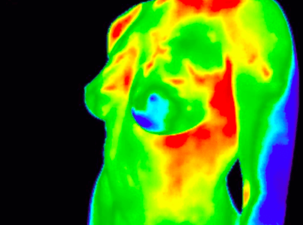 breast thermography